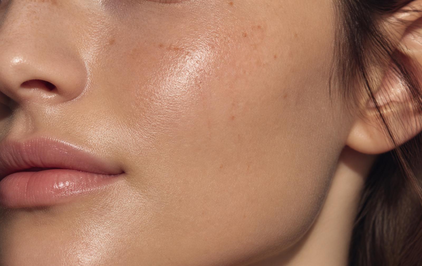 Doctor gently assessing a patient's facial skin during a Skin Rejuvenation Consultation at the Chelsea clinic.